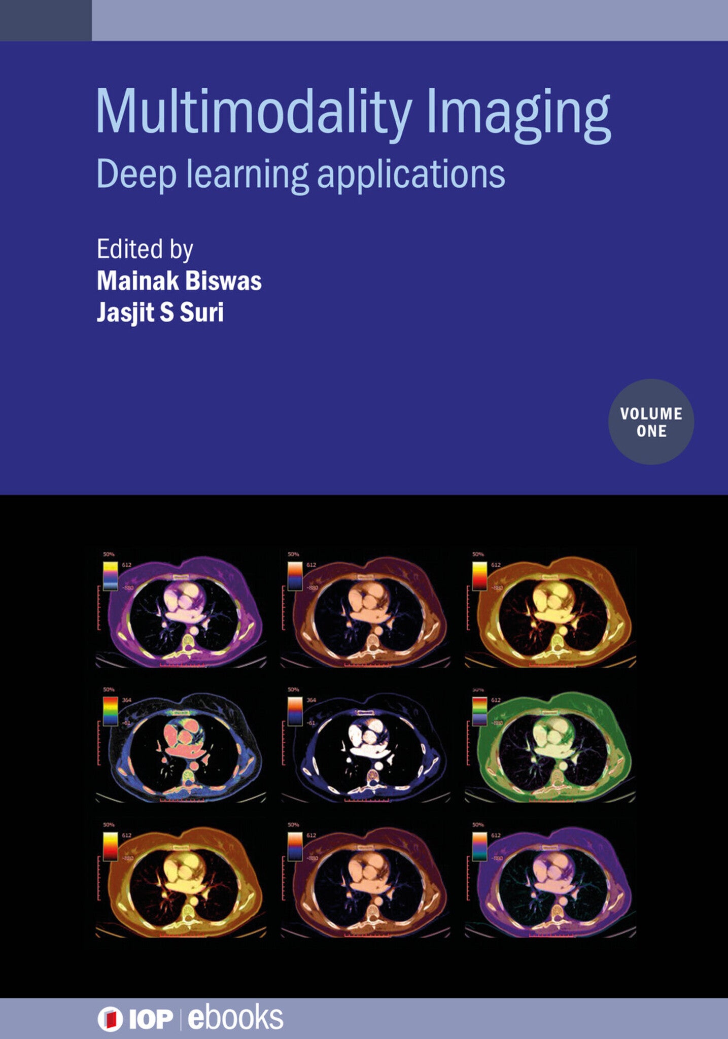 Multimodality Imaging, Volume 1